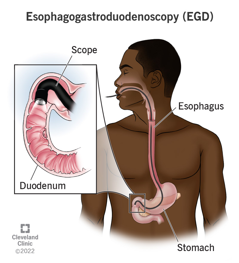 Gastroenterology